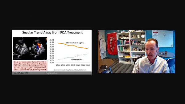 Physiologic Spectrum on PDA